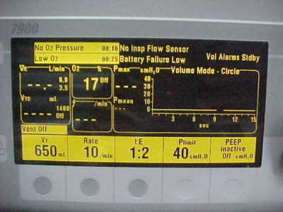 Ohmeda modulus se anesthesia machine with 7900 vent