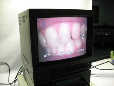 Perspective dental imaging system intra oral camera set